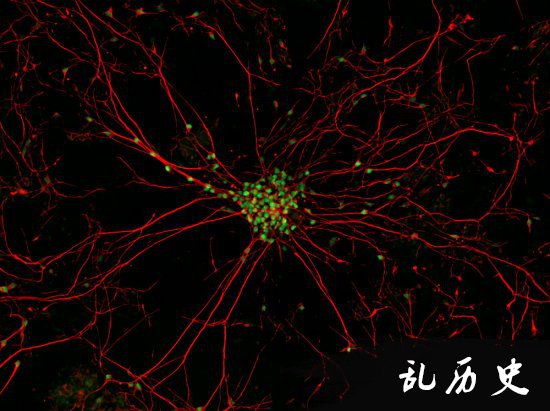 最佳年度生物显微照片，水蚤微观照居首(todayonhistory.com)